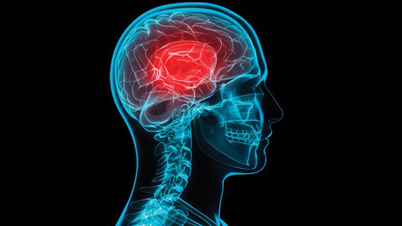 Concussion therapy